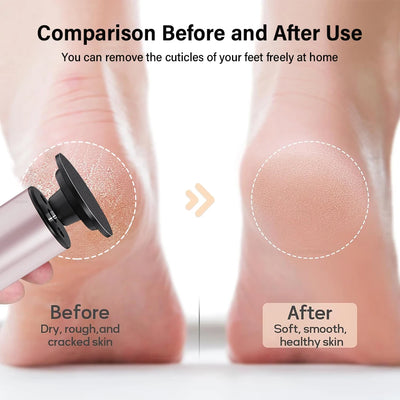 Electric Foot Callus Remover